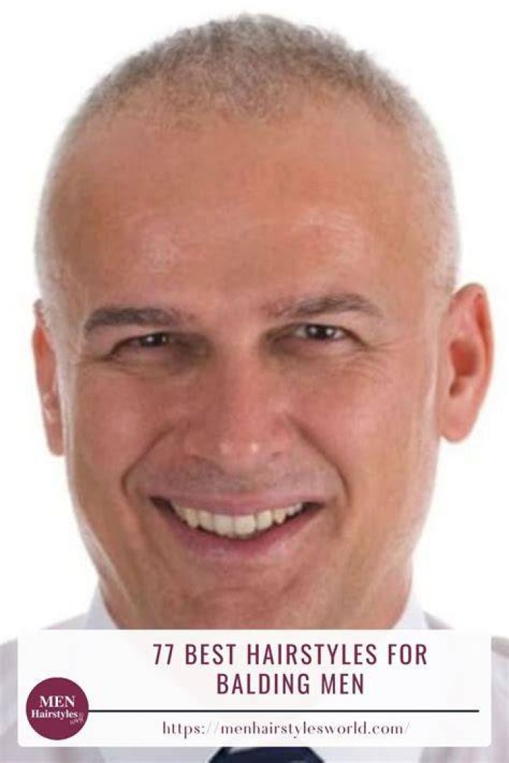 7 Bad Hairstyles Bald Men Need To Avoid Bad haircut, Bad hair, Balding
