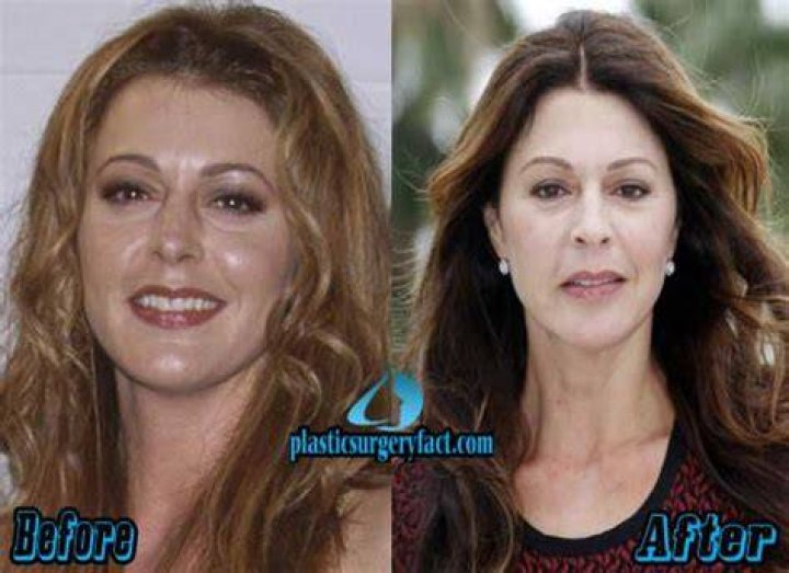 Has Jane Leeves Had Plastic Surgery? Body Measurements and More