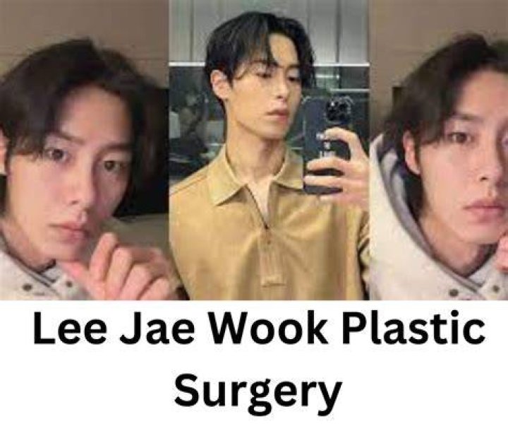 Lee Jae Wook Plastic Surgery Exploring the Truth Behind Celebrity