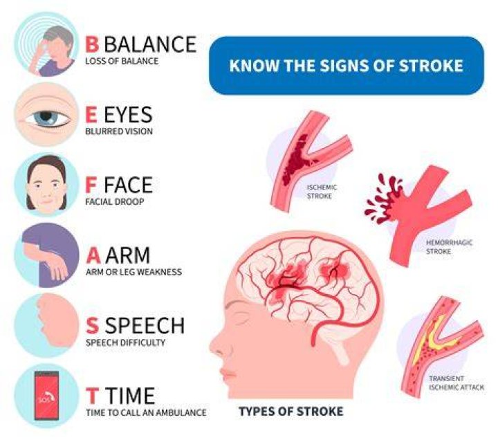 signs of mini stroke signs of mini strokesigns of mini stroke
